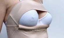 Augmentation mammaire sans prothèses mammaires